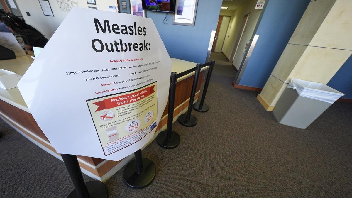 Second child died from measles-related causes in West Texas, where cases are nearing 500