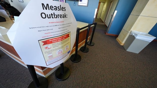 Measles outbreaks spark concern over rare ‘horrific’ neurological disorder