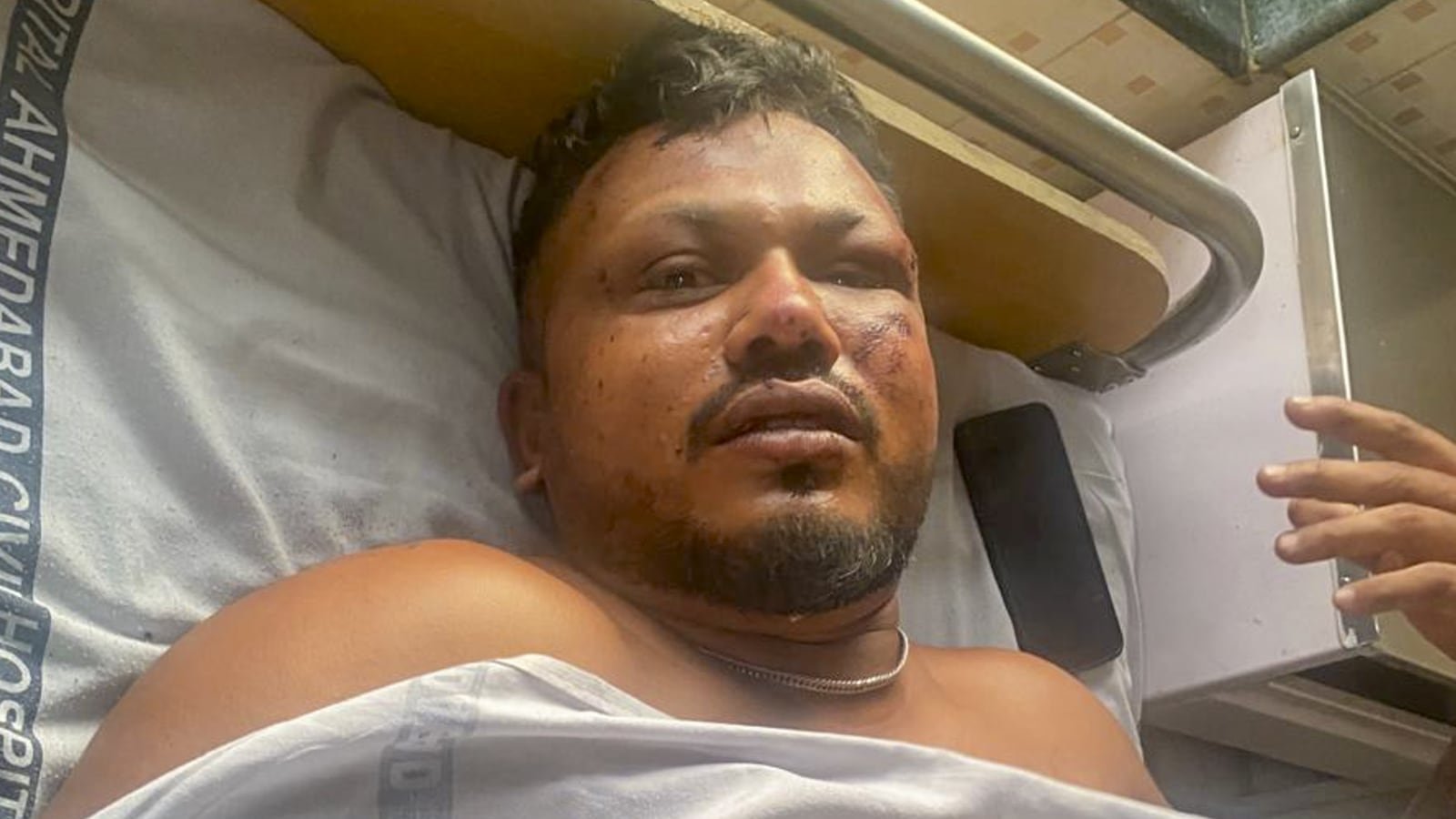 Ahmedabad plane crash: The 11 A miracle – ‘Don’t know how I’m alive’ | Ahmedabad News Ahmedabad plane crash: The 11 A miracle – ‘Don’t know how I’m alive’ | Ahmedabad News