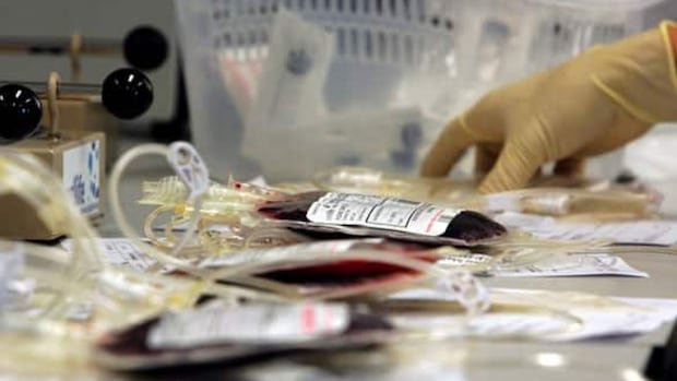 Edmonton blood bank continues to pose contamination risks, Health Canada cautions