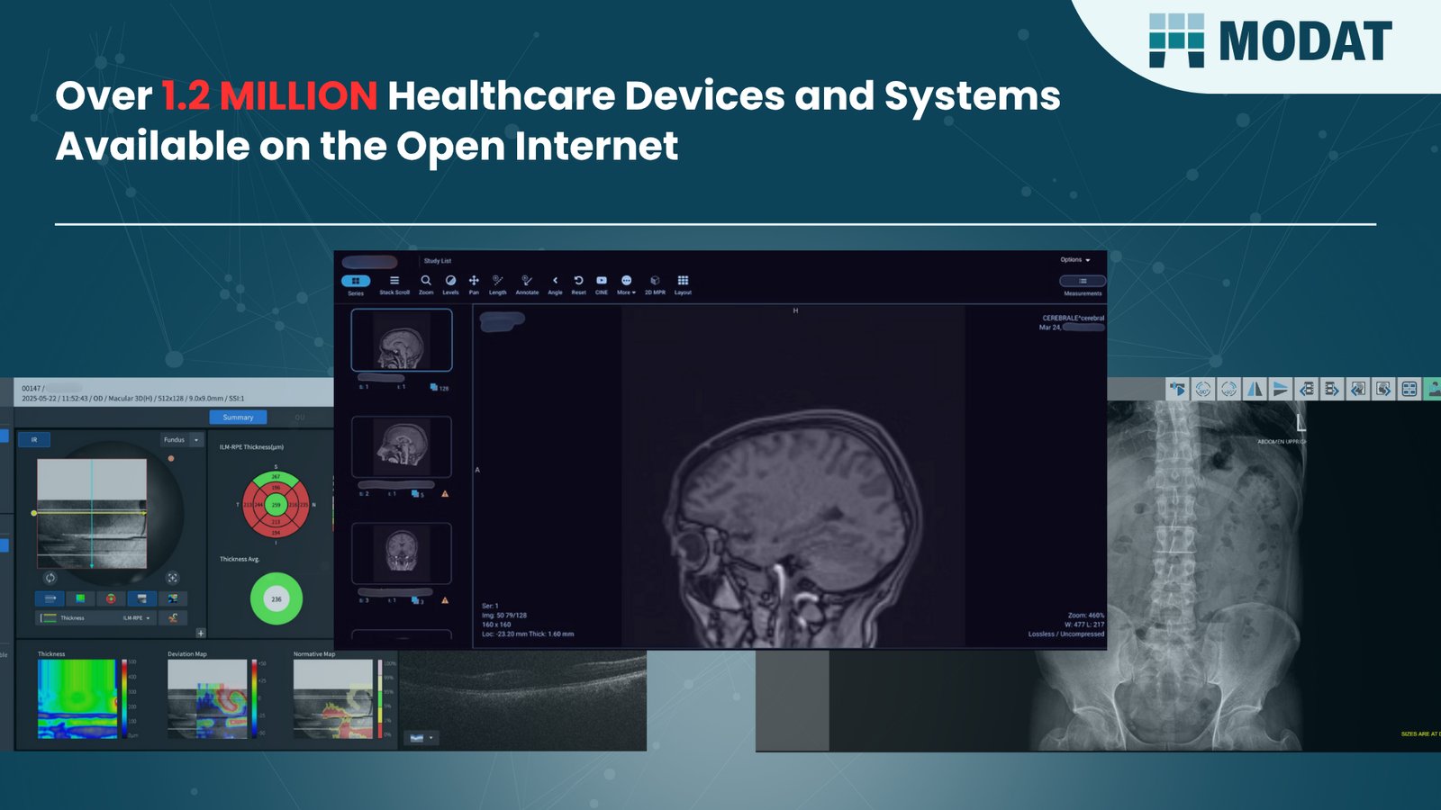 1.2 Million Healthcare Devices and Systems Found Exposed Online