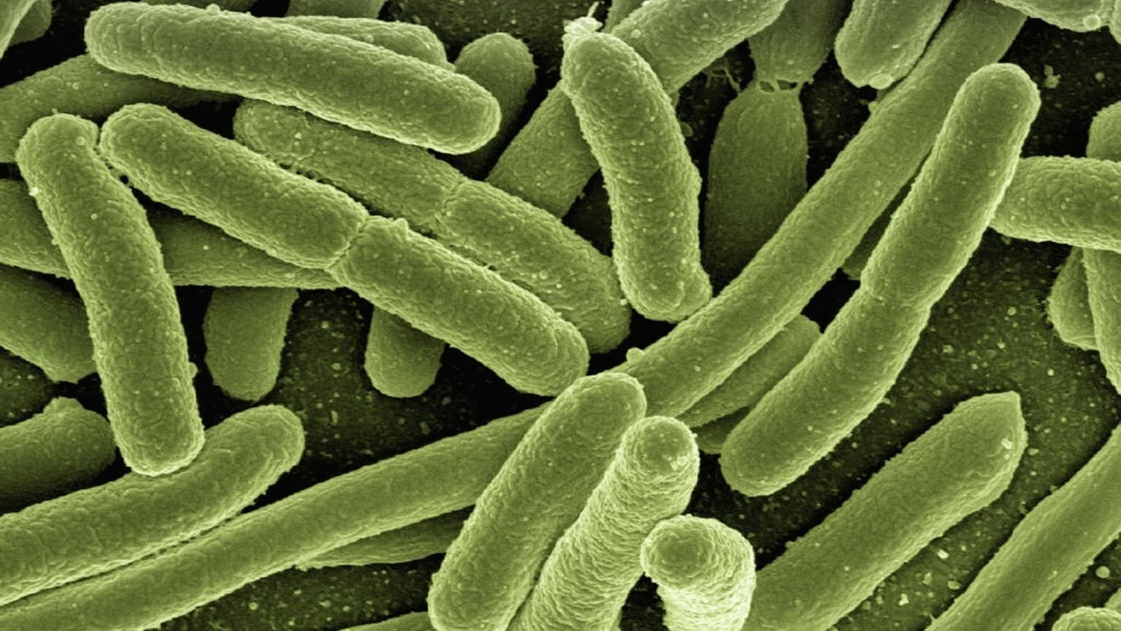California resident tests positive for plague after camping trip | World News