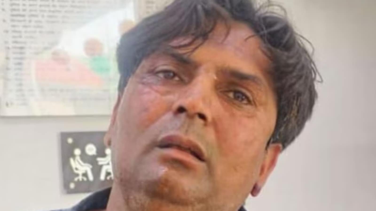The accused in attack on CM: An auto driver booked in 5 cases and a dog lover with ‘mental health issues’ | Ahmedabad News